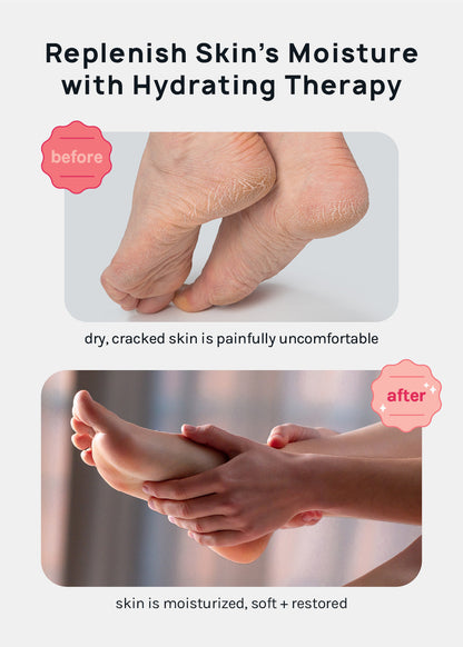 A+ Gel Lined Moisturizing Spa Sock